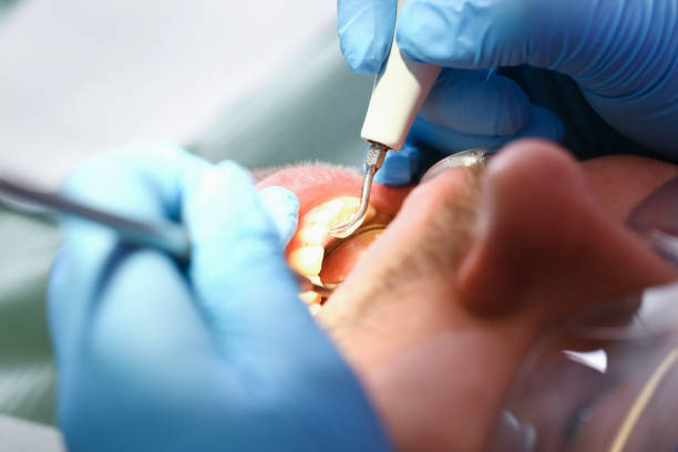 Emergency Dentist for Kids in MO